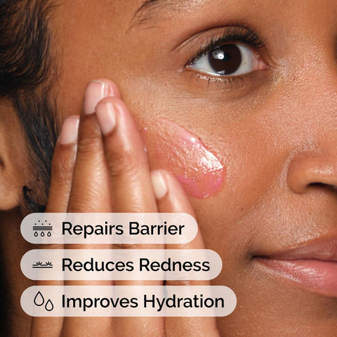 V2H651F860BD132457F9CF5C13A02D7CE40R7479210P7